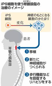 ｉＰＳ細胞を使う脊髄損傷の治療のイメージ図