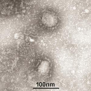 新型コロナウイルスの電子顕微鏡写真